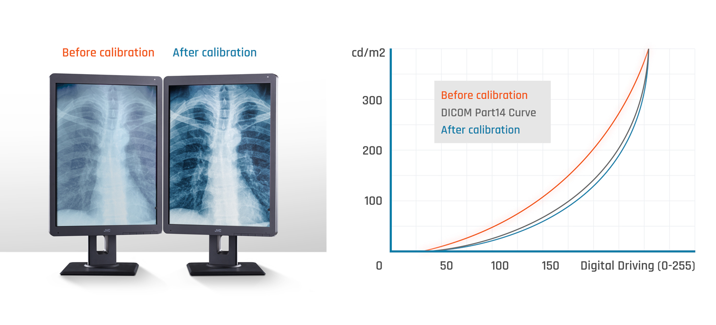 Before and after DICOM calibration