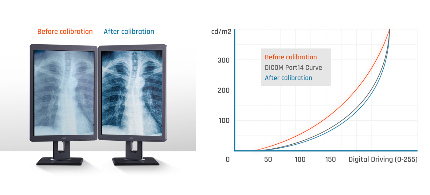  monitor calibrati con preset DICOM in confronto e un grafico che mostra le differenze tra i diversi preset.